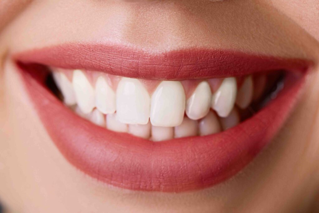 Sbiancamento denti: come mantenere il tuo sorriso luminoso 1 sbiancamento denti a Anzola dell'Emilia