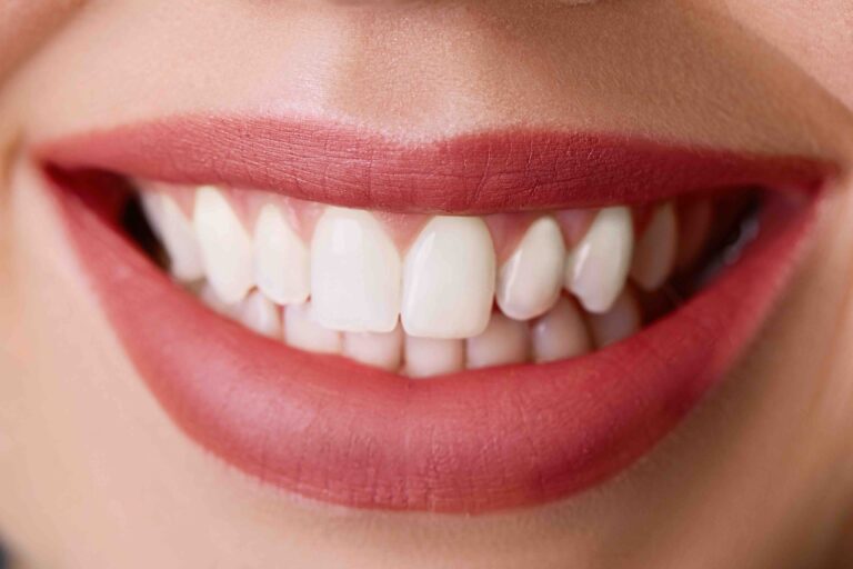 Blog 1 sbiancamento denti a Anzola dell'Emilia