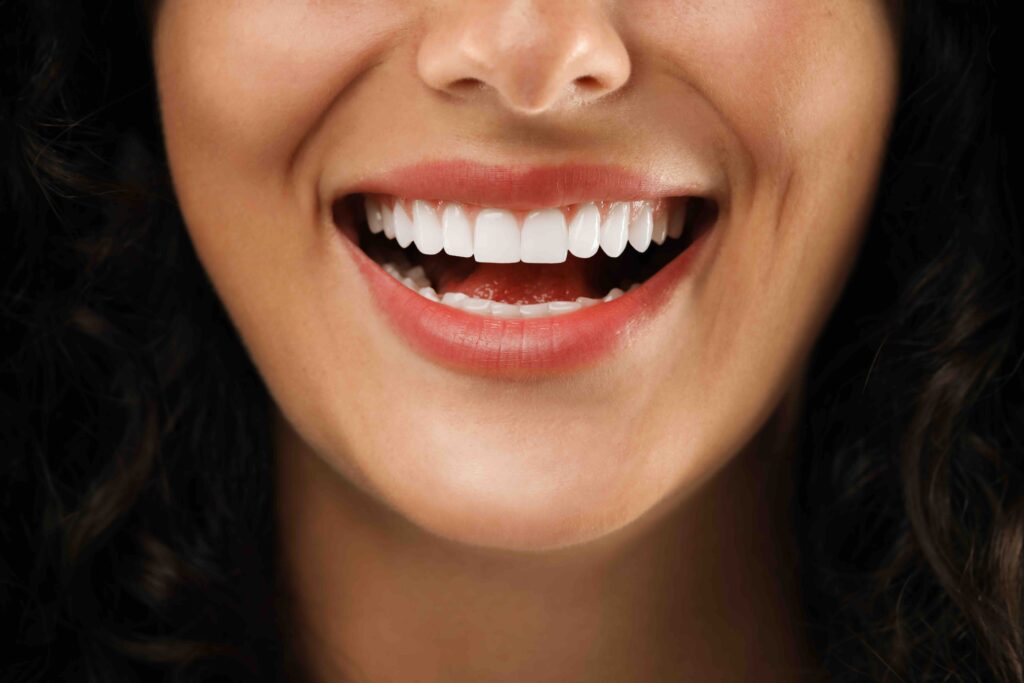 Sbiancamento Denti Professionale: Come Funziona e Cosa Sapere 1 Sbiancamento denti professionale a Anzola dell'Emilia