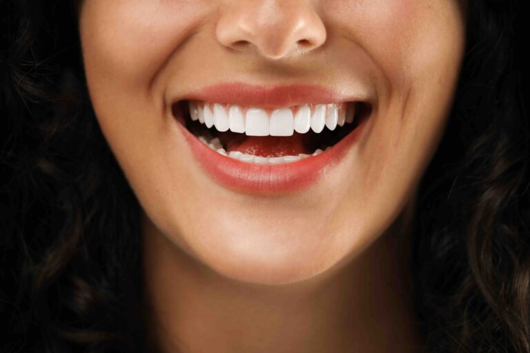 Blog 2 Sbiancamento denti professionale a Anzola dell'Emilia